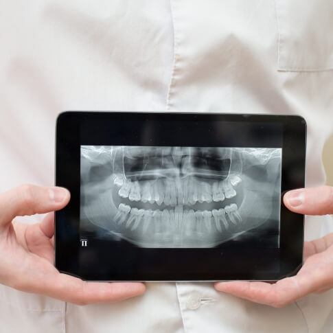 Digital x rays on tablet computer