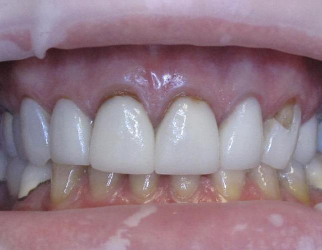Case 1 Before
