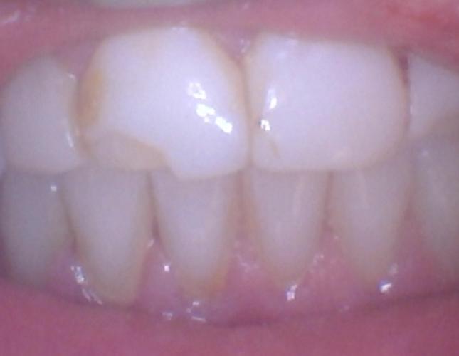 Case 2 Before