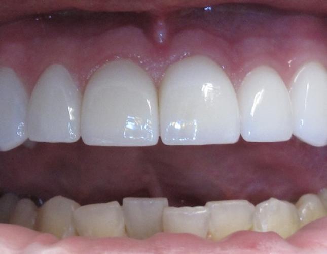 Case 5 After