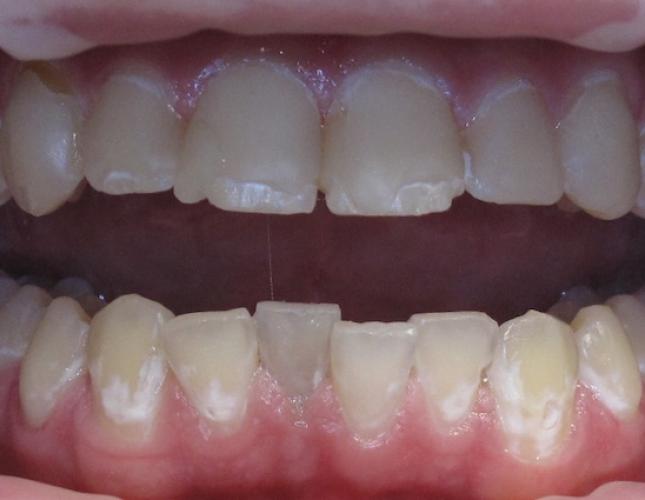 Case 5 Before