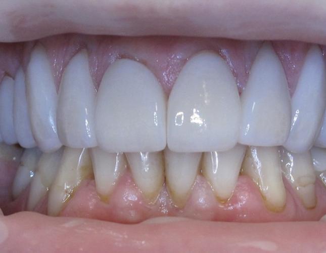 Case 7 After