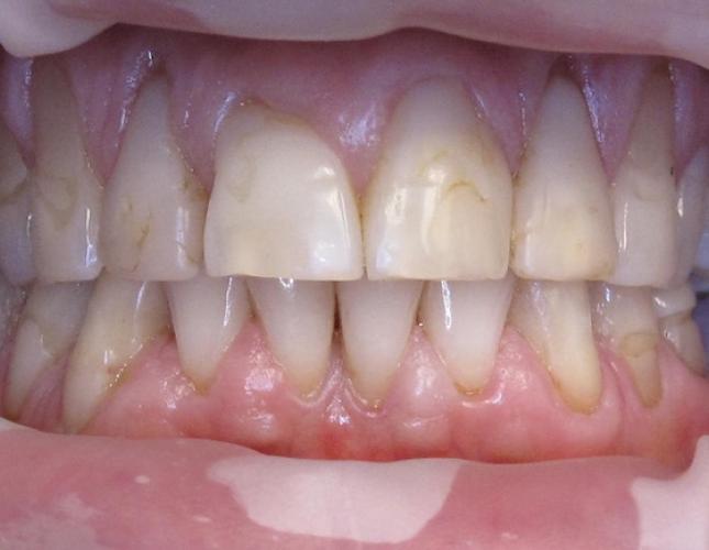 Case 7 Before